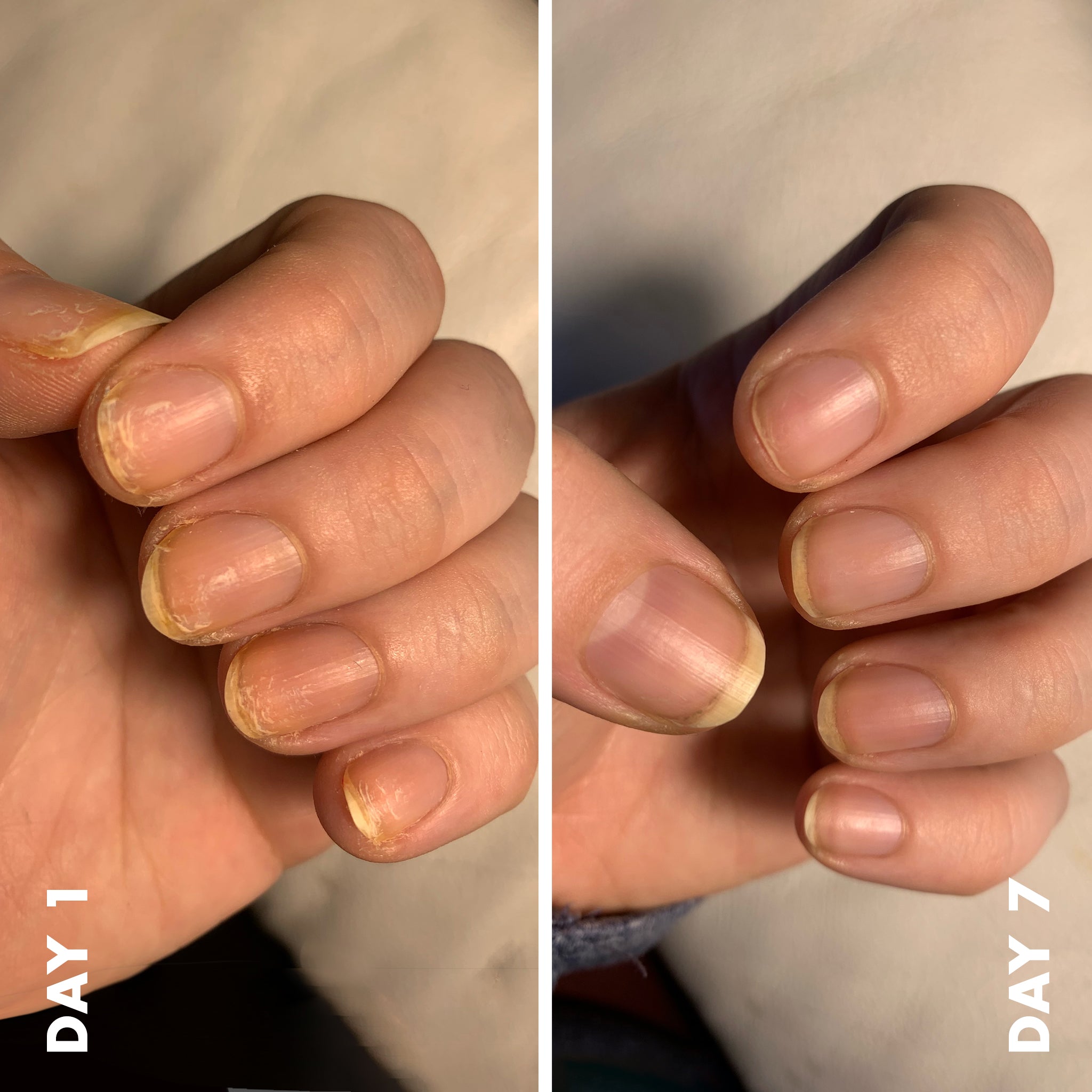 Nail Strengthener - Image 4